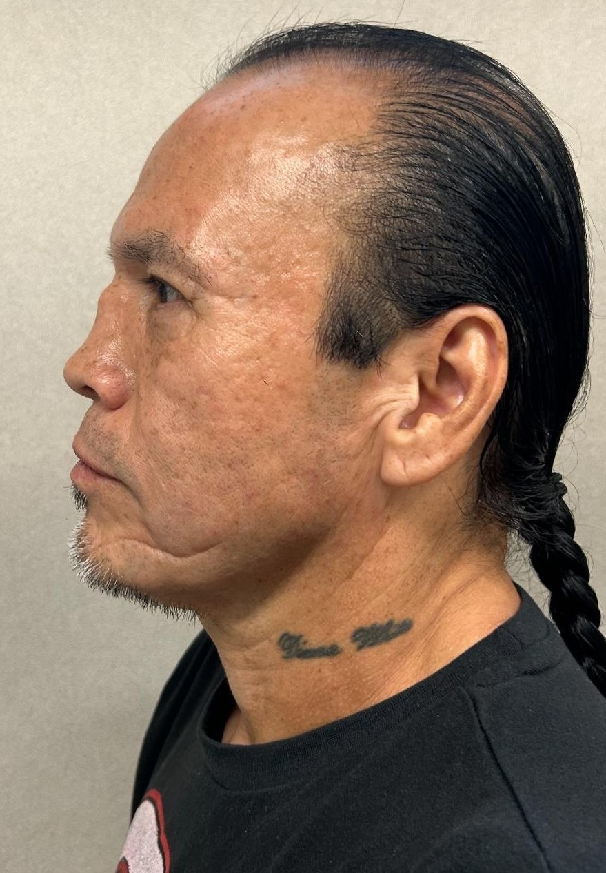 Mugshot Side